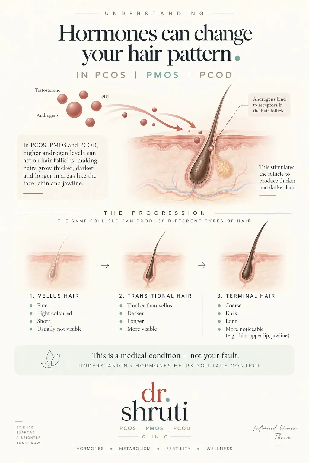 Understanding how hormones can change your hair pattern in PCOS, PMOS and PCOD - Dr. Shruti Shah